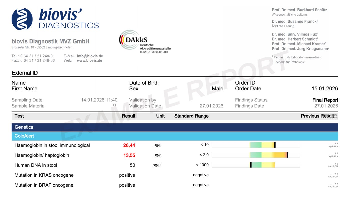 Example ColoAlert laboratory report showing raised haemoglobin and haemoglobin–haptoglobin, normal human DNA, and positive KRAS and BRAF mutations